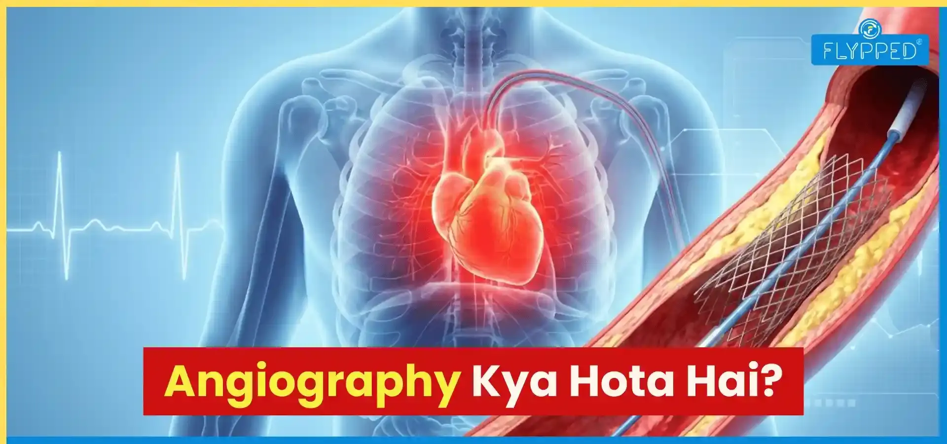 Angiography Kya Hota Hai? जानें टेस्ट, प्रक्रिया और खर्च की जानकारी