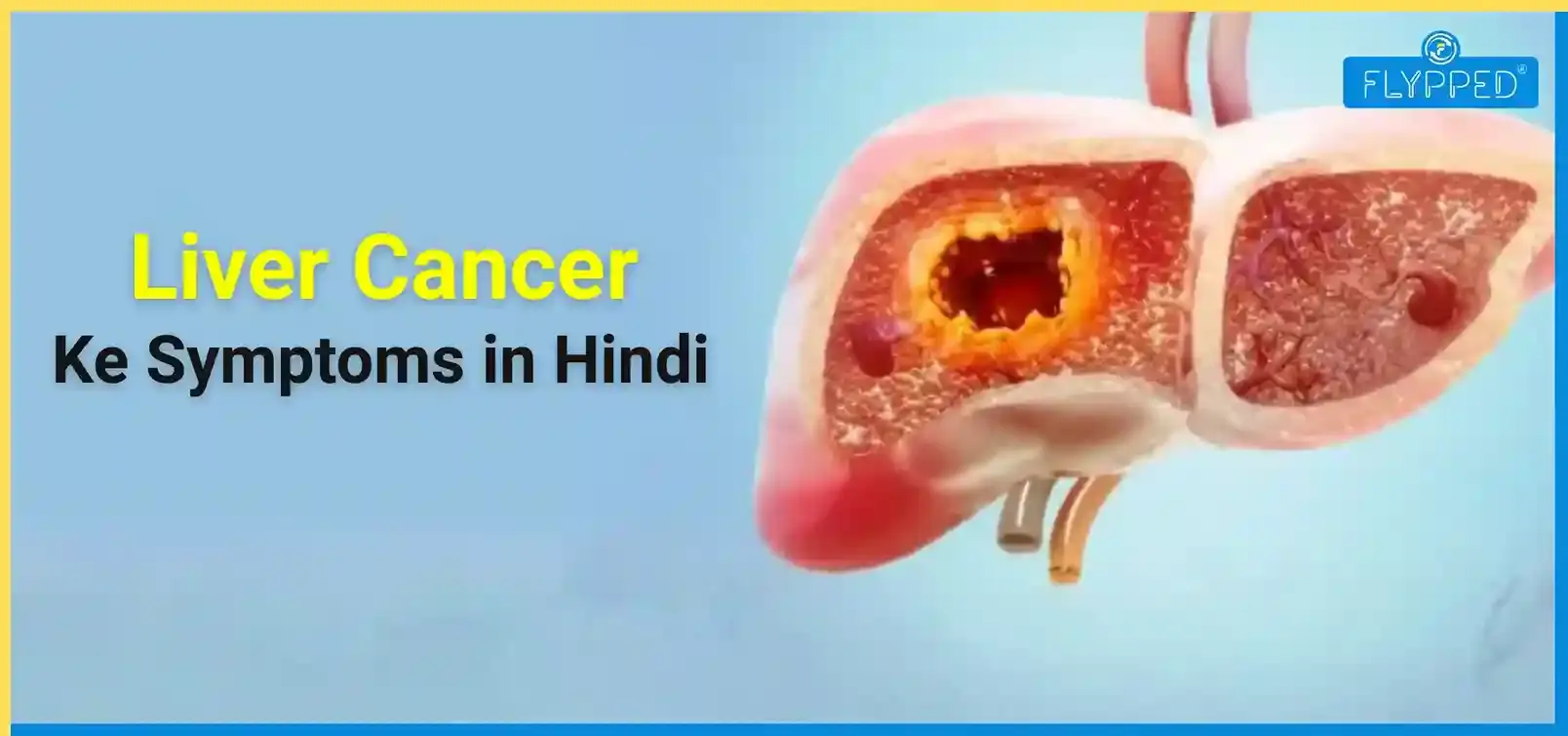 Liver Cancer Ke Symptoms in Hindi: लक्षण, कारण और स्टेज